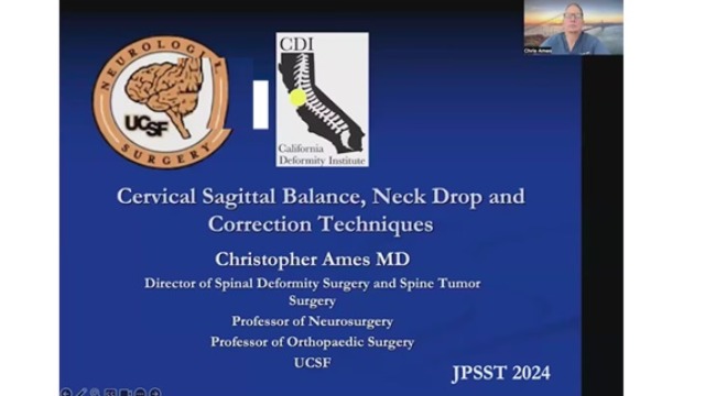 Cervical Sagittal Balance, Neck Drop and Correction Techniques