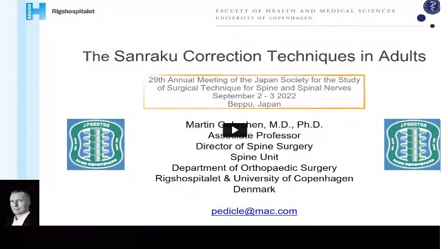 Dr Martin Gehrchen's presentation in International Online Debate Program of 29th JPSTSS on 2 Sep 2022
"The Sanraku Correction Techniques in Adults"