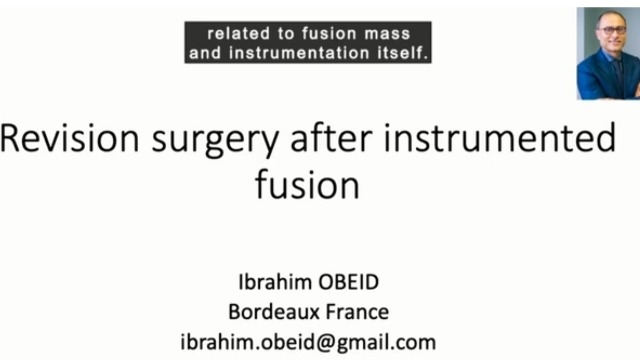 Dr Ibrahim Obeid's presentation in International Online Debate Program of 28th JPSTSS on 3 Sep 2021
"Revision surgery after instrumented fusion"